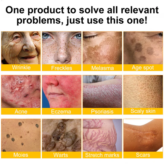 🔥FDA Approved:  Bee Venom Skin Restoration Cream — 🔥Limited Time 80% OFF🔥